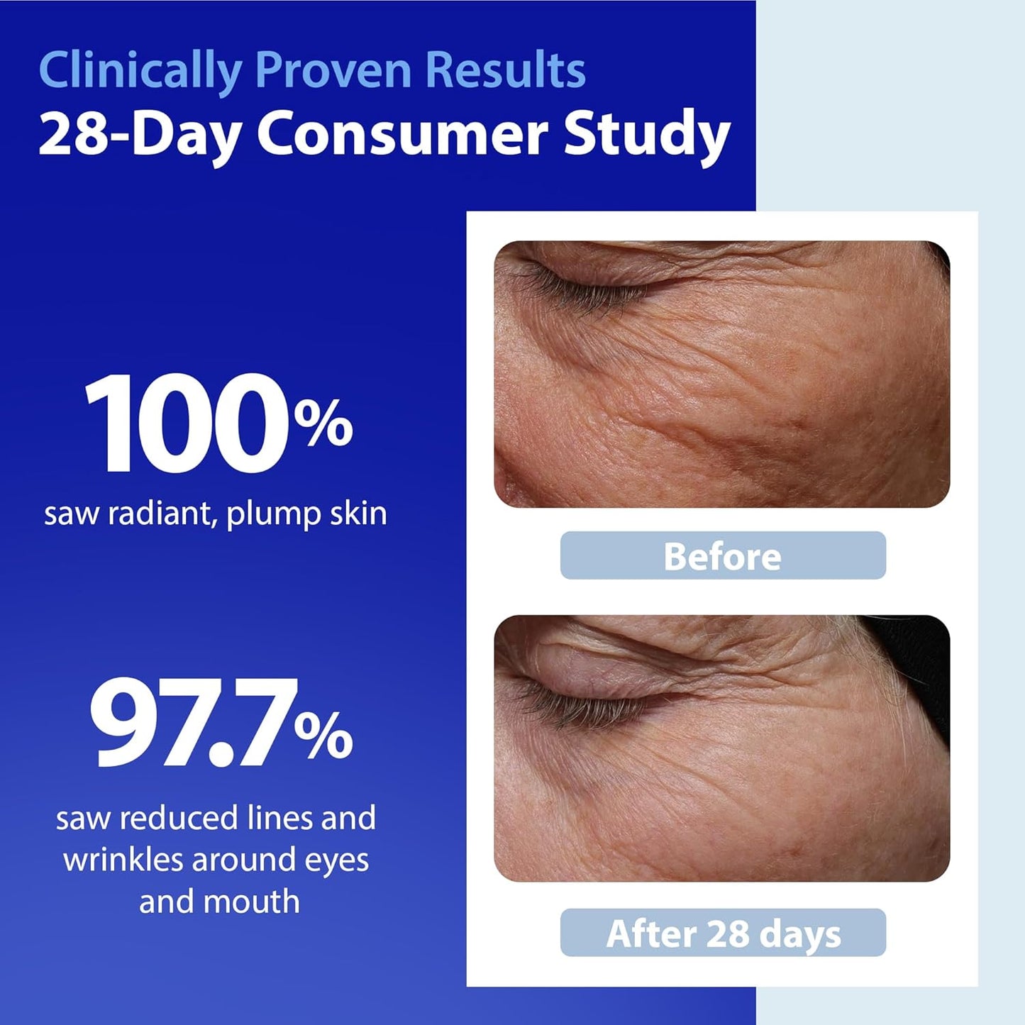 Skinscience Hydroshield Retinol Serum for Face 4 Oz – Dermatologist Tested Hydrating Serum, Contains Retinol and Ceramides for Deep Moisture - Cruelty Free