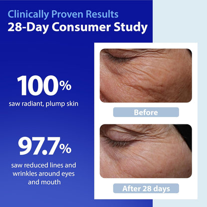 Skinscience Hydroshield Retinol Serum for Face 4 Oz – Dermatologist Tested Hydrating Serum, Contains Retinol and Ceramides for Deep Moisture - Cruelty Free